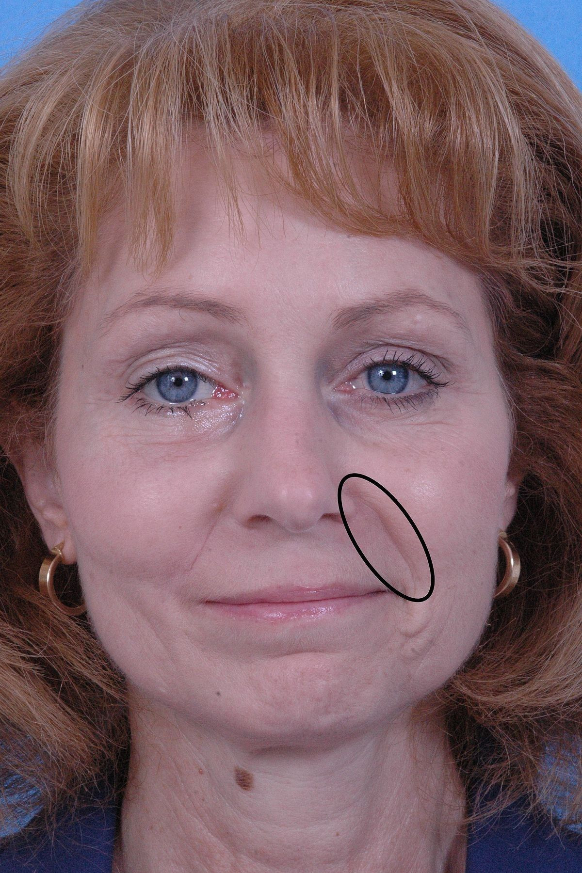 关于?頰?的信息